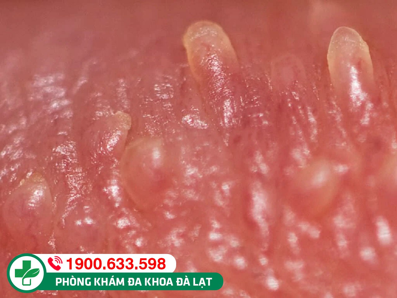 Hình ảnh minh họa